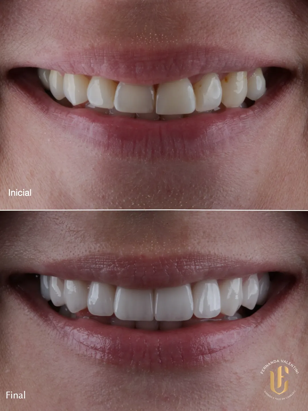 Transformação Sculpt Face