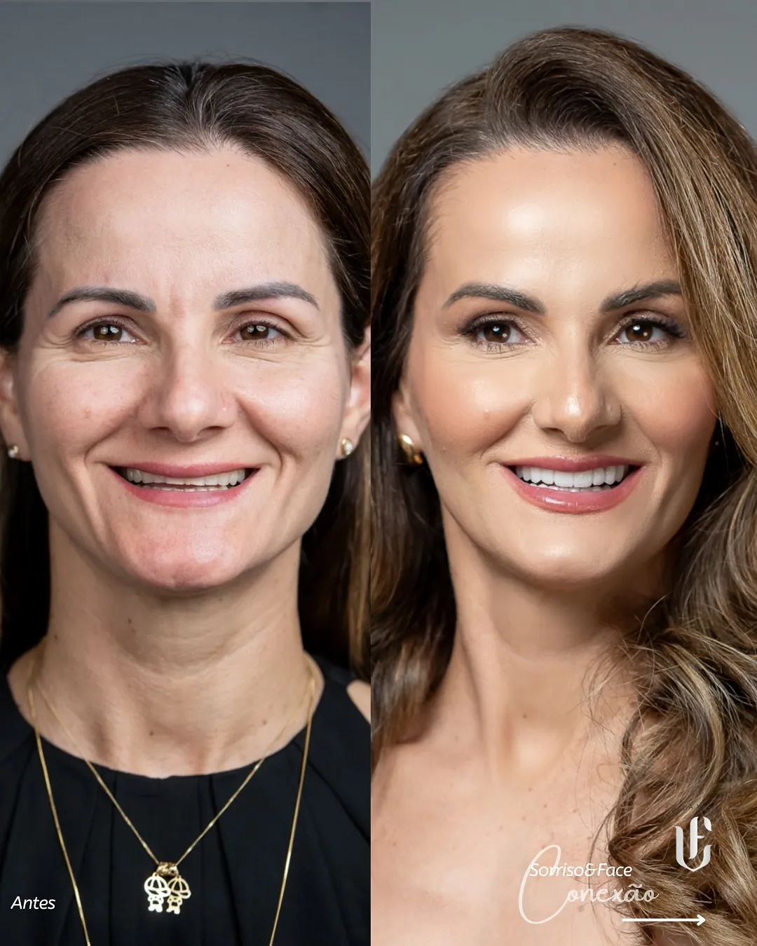 Transformação Sculpt Face