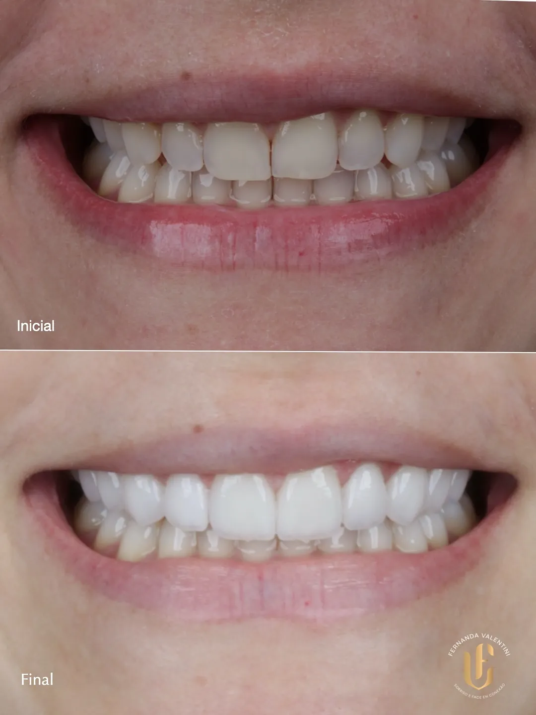 Transformação Sculpt Face
