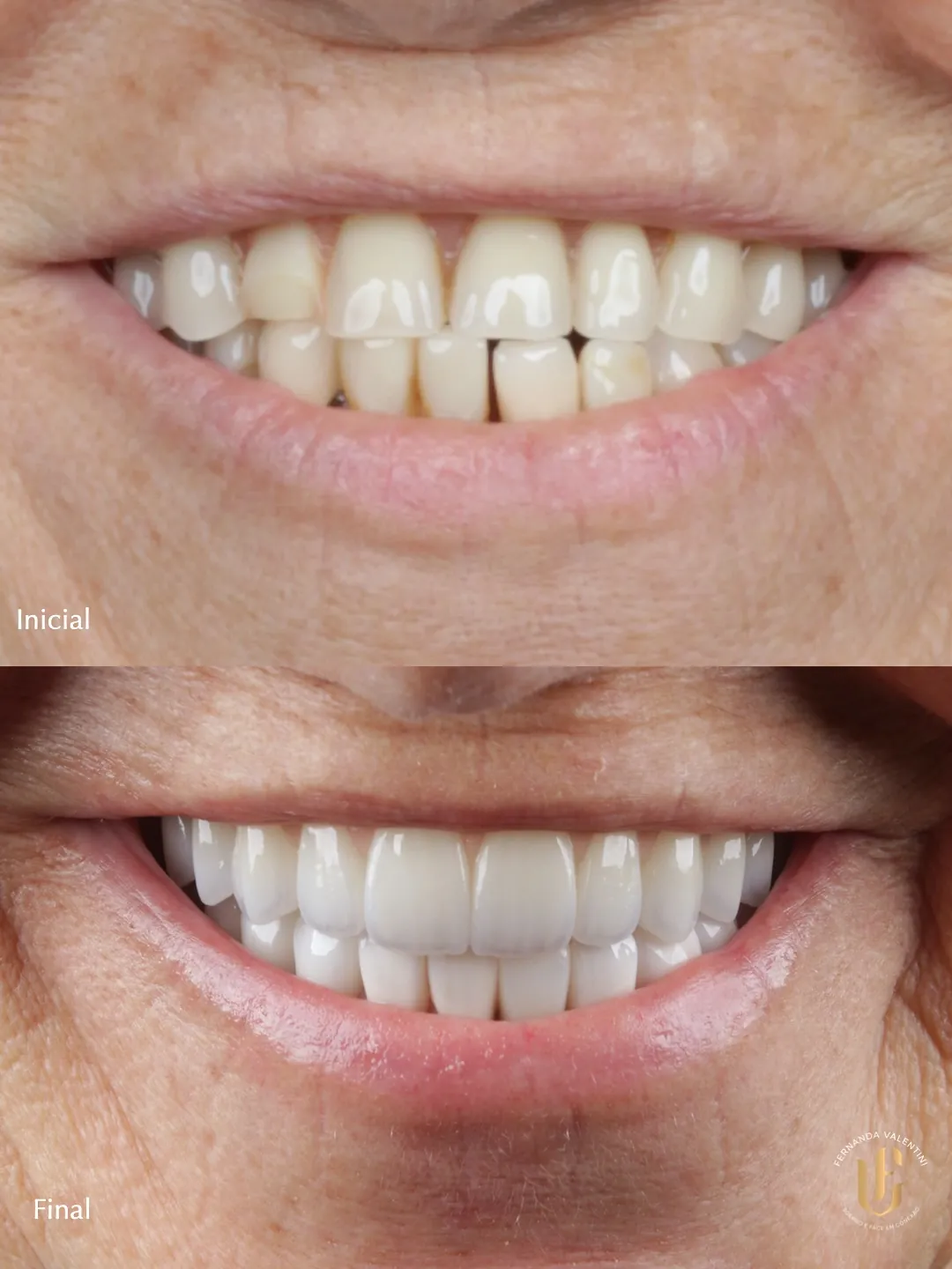 Transformação Sculpt Face