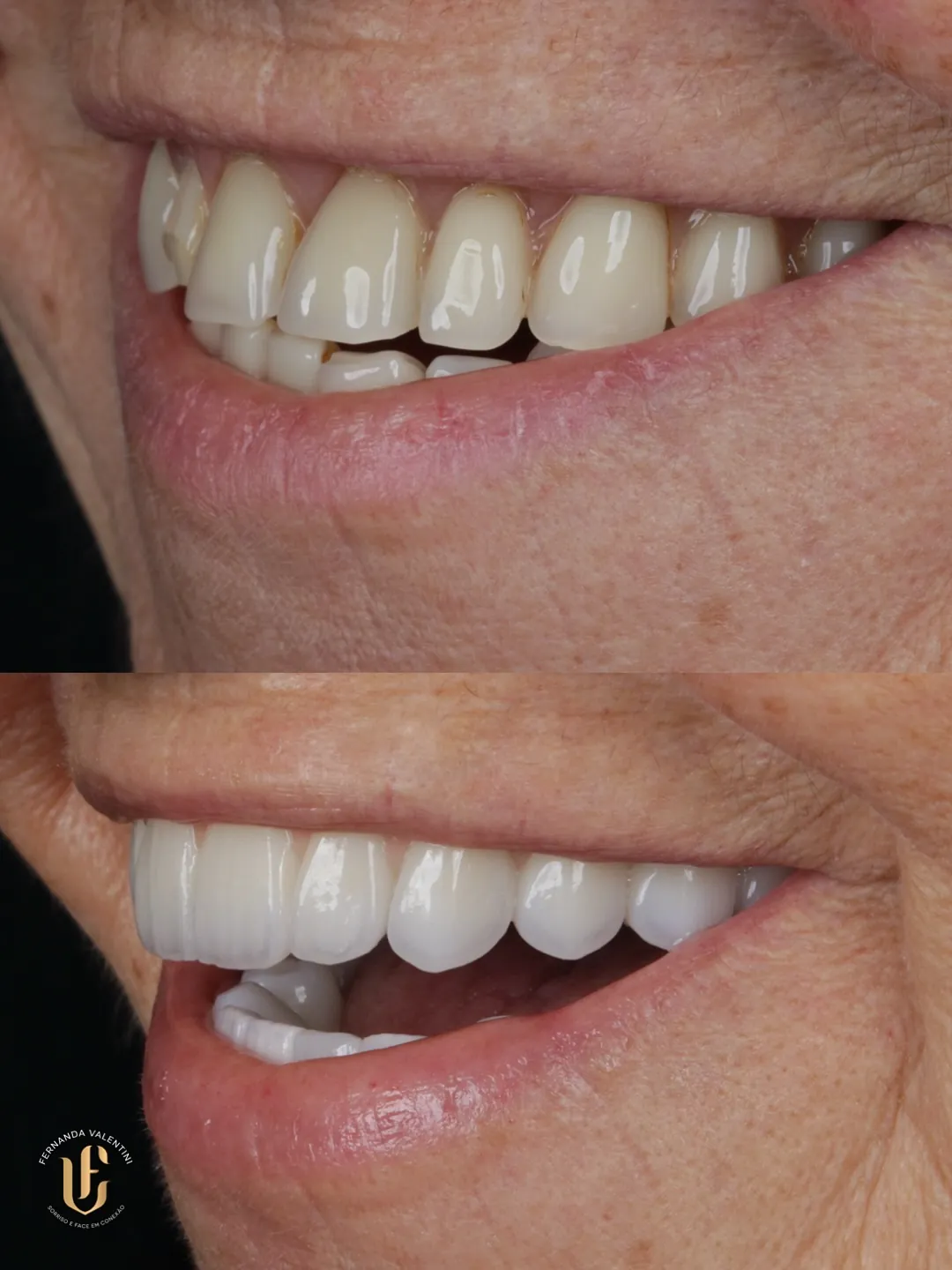 Transformação Sculpt Face