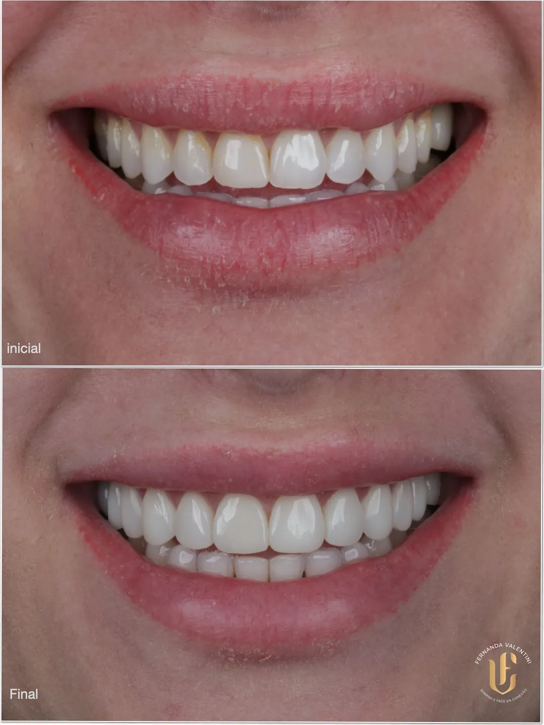 Transformação Sculpt Face