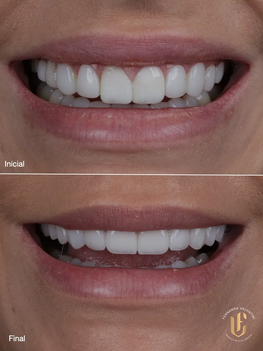 Transformação Sculpt Face